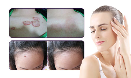 Medizinisches Schneiden: