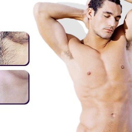 Brusthaarentfernung: