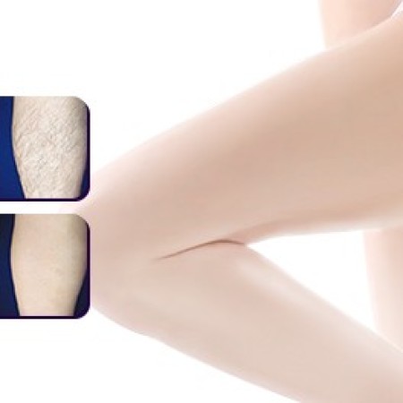 Haarentfernung am Bein: