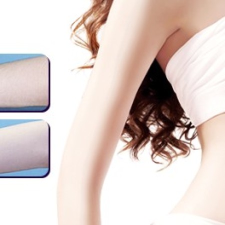 Haarentfernung am Arm: